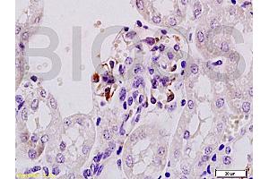 Formalin-fixed and paraffin embedded mouse kidney tissue labeled Anti-Mouse IgA Polyclonal Antibody, Unconjugated (ABIN673041) at 1:200, followed by conjugation to the secondary antibody and DAB staining (Rabbit anti-Mouse IgA Antibody)