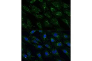 Immunofluorescence analysis of U-2 OS cells using NDUFB4 Polyclonal Antibody (ABIN6133349, ABIN6144476, ABIN6144477 and ABIN7101430) at dilution of 1:100 (40x lens).