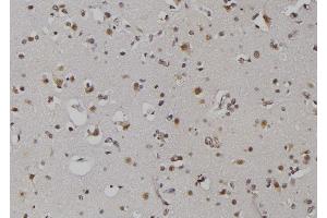 ABIN6279367 at 1/100 staining Human brain tissue by IHC-P. (ZNRD1 antibody  (Internal Region))