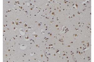ABIN6279367 at 1/100 staining Human brain tissue by IHC-P. (ZNRD1 antibody  (Internal Region))
