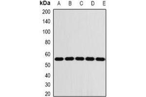 Western blot analysis of FKBP8 expression in Jurkat (A), THP1 (B), mouse liver (C), mouse eye (D), rat brain (E) whole cell lysates. (FKBP8 antibody)