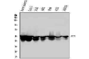Western blot analysis of Cytokeratin 8 using anti-Cytokeratin 8 antibody (ABIN6719478). (KRT8 antibody  (AA 107-325))