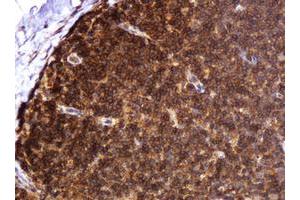 Image no. 3 for anti-B and T Lymphocyte Associated (BTLA) antibody (ABIN1496983)