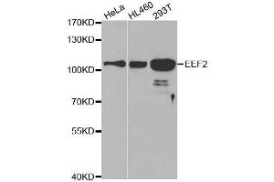 Western blot analysis of extracts of various cell lines, using EEF2 antibody. (EEF2 antibody  (AA 1-290))