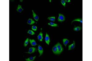 Immunofluorescence staining of A549 cells with ABIN7148830 at 1:66, counter-stained with DAPI. (GARP antibody  (AA 131-253))