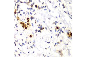 Immunohistochemistry of paraffin-embedded human esophagus using S100A12 antibody (ABIN6291358) at dilution of 1:100 (40x lens). (S100A12 antibody)