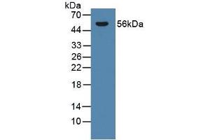 Detection of CYP21A2 in Rat Adrenal Gland Tissue using Polyclonal Antibody to Cytochrome P450 Family 21 Subfamily A Member 2 (CYP21A2) (CYP21A2 antibody  (AA 106-389))