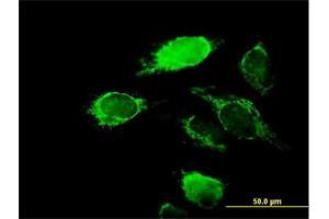 Immunofluorescence of purified MaxPab antibody to KCNIP2 on HeLa cell. (KCNIP2 antibody  (AA 1-270))