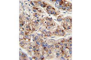 Immunohistochemistry (IHC) image for anti-Enoyl-CoA, Hydratase/3-Hydroxyacyl CoA Dehydrogenase (EHHADH) antibody (ABIN3003844) (EHHADH antibody)