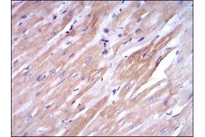 Immunohistochemistry (IHC) image for anti-Fast Skeletal Troponin I (TNNI2) antibody (ABIN969441)