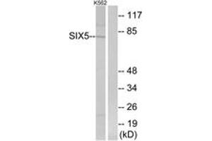 Western Blotting (WB) image for anti-Homeobox protein SIX5 (SIX5) (AA 201-250) antibody (ABIN2890384) (Six5 antibody  (AA 201-250))