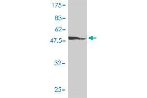 Western Blot detection against Immunogen (48. (ETV4 antibody  (AA 1-207))