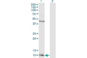 Western Blot analysis of CCL2 expression in transfected 293T cell line by CCL2 monoclonal antibody (M12), clone 4B12. (CCL2 antibody  (AA 1-99))