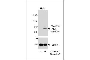 Western blot analysis of lysates from Hela cell line, untreated or treated with IL-1beta(20 ng/mL) +Calyculin A(100 nM), using  (upper) or Tubulin (lower). (TR4 antibody  (pSer439))
