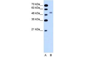SLC12A1 antibody used at 1 ug/ml to detect target protein. (SLC12A1 antibody)