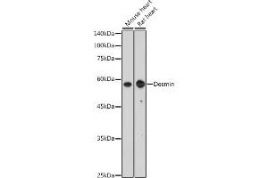 Western blot analysis of extracts of C2C12 cells, using Desmin antibody (ABIN3021114, ABIN3021115, ABIN3021116 and ABIN6213957) at 1:400 dilution. (Desmin antibody  (AA 121-470))