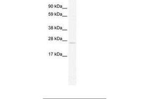 TCF23 antibody  (C-Term)