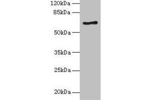 Western blot All lanes: ALAS2 antibody at 6 μg/mL + K562 whole cell lysate Secondary Goat polyclonal to rabbit IgG at 1/10000 dilution Predicted band size: 65, 61, 50, 64 kDa Observed band size: 65 kDa (ALAS2 antibody  (AA 50-587))
