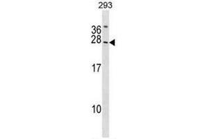 SYNGR2 Antibody (N-term) western blot analysis in 293 cell line lysates (35µg/lane). (SYNGR2 antibody  (N-Term))