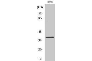 Western Blotting (WB) image for anti-MEF2BNB-MEF2B Readthrough (MEF2BNB-MEF2B) (Internal Region) antibody (ABIN3185512) (MEF2BNB-MEF2B Readthrough (MEF2BNB-MEF2B) (Internal Region) antibody)