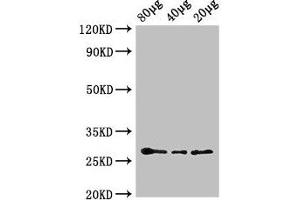 L-Ascorbate Peroxidase 2 (APX2) (AA 4-250) antibody (HRP)