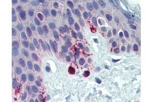 Anti-TYRP1 /gp75 antibody IHC of human skin. (Tyrosinase-Related Protein 1 antibody  (AA 396-445))