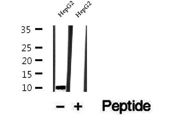 UQCRQ antibody  (Internal Region)