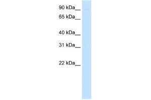 WB Suggested Anti-SIRT1 Antibody   Titration: 0. (SIRT1 antibody  (N-Term))
