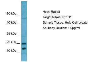 Western Blotting (WB) image for anti-Ribosomal Protein L11 (RPL11) (C-Term) antibody (ABIN2789802) (RPL11 antibody  (C-Term))