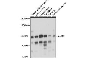 Western blot analysis of extracts of various cell lines, using  antibody (ABIN7265626) at 1:1000 dilution. (Anoctamin 5 antibody  (AA 1-300))