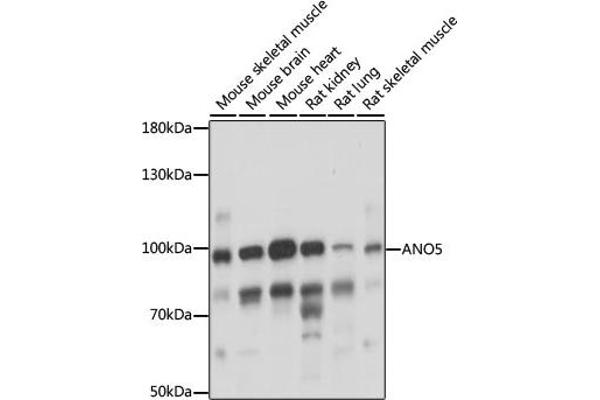 Anoctamin 5 antibody  (AA 1-300)