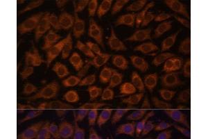 Immunofluorescence analysis of L929 cells using TLR3 Polyclonal Antibody at dilution of 1:100. (TLR3 antibody)