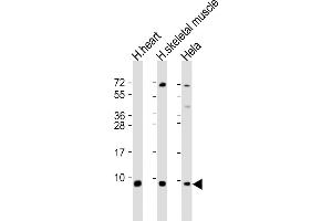 All lanes : Anti-ATP5E Antibody (C-Term) at 1:2000 dilution Lane 1: human heart lysate Lane 2: human skeletal muscle lysate Lane 3: Hela whole cell lysate Lysates/proteins at 20 μg per lane. (ATP5E antibody  (AA 21-51))