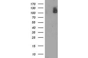 Western Blotting (WB) image for anti-phosphodiesterase 2A, CGMP-Stimulated (PDE2A) antibody (ABIN1500076)
