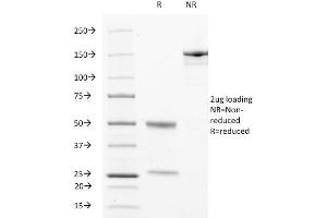 SDS-PAGE Analysis Purified CD63 Mouse Monoclonal Antibody (529). (CD63 antibody)