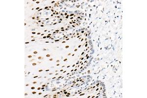 Immunohistochemistry of paraffin-embedded human esophagus using PCNA antibody (ABIN6133630, ABIN6139020, ABIN6139022 and ABIN7101400) at dilution of 1:2700 (40x lens). (PCNA antibody)