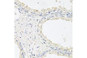 Immunohistochemistry of paraffin-embedded human prostate using EPOR antibody. (EPOR antibody)