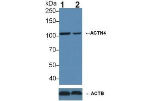 Knockout Varification: ;Lane 1: Wild-type MCF7 cell lysate; ;Lane 2: ACTN4 knockout MCF7 cell lysate; ;Predicted MW: 104,79,59kDa ;Observed MW: 104kDa;Primary Ab: 3µg/ml Rabbit Anti-Human ACTN4 Antibody;Second Ab: 0. (alpha Actinin 4 antibody  (AA 1-269))