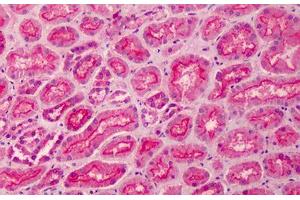 Human Kidney: Formalin-Fixed, Paraffin-Embedded (FFPE) (MPP5 antibody  (AA 174-187))