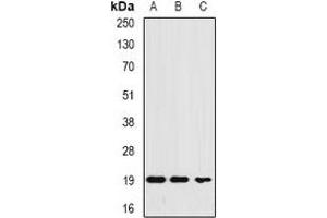 Western blot analysis of Ferritin L expression in HEK293T (A), MCF7 (B), HepG2 (C) whole cell lysates.