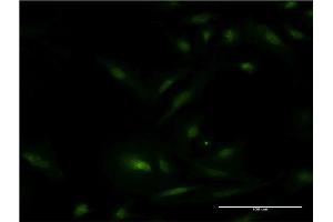 Immunofluorescence of monoclonal antibody to ESR1 on HeLa cell. (Estrogen Receptor alpha antibody  (AA 41-140))