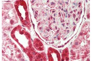 Rabbit Anti-EIF4H antibody  Formalin Fixed Paraffin Embedded Tissue: Human Kidney Primary antibody Concentration: 1:200 Secondary Antibody: Donkey anti-Rabbit-Cy3 Secondary Antibody Concentration: 1:200 Magnification: 20x Exposure Time: 0. (EIF4H antibody  (C-Term))