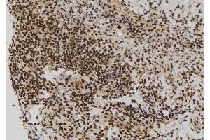 ABIN6272905 at 1/100 staining Human spleen tissue by IHC-P. (RBM15 antibody  (N-Term))