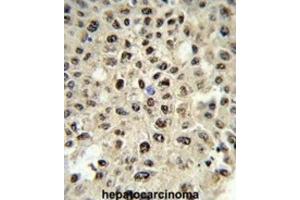 Immunohistochemistry (IHC) image for anti-Sjogren Syndrome Antigen B (SSB) antibody (ABIN3001636) (SSB antibody)