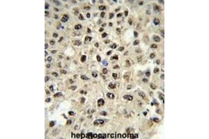 Immunohistochemistry (IHC) image for anti-Sjogren Syndrome Antigen B (SSB) antibody (ABIN3001636)