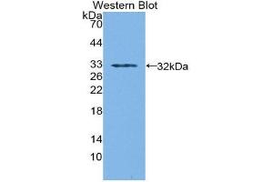 Western Blotting (WB) image for anti-Sorbitol Dehydrogenase (SORD) (AA 98-355) antibody (ABIN1870684)