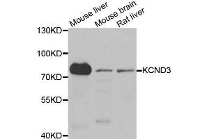 Western blot analysis of extracts of various cell lines, using KCND3 antibody. (KCND3 antibody)