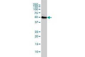 RNU3IP2 monoclonal antibody (M01), clone 1E8 Western Blot analysis of RNU3IP2 expression in Jurkat . (RRP9 antibody  (AA 1-475))