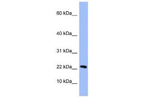 PIN4 antibody used at 1 ug/ml to detect target protein. (PIN4 antibody  (Middle Region))