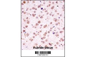 Mouse Chuk Antibody immunohistochemistry analysis in formalin fixed and paraffin embedded mouse brain tissue followed by peroxidase conjugation of the secondary antibody and DAB staining. (IKK alpha antibody  (C-Term))